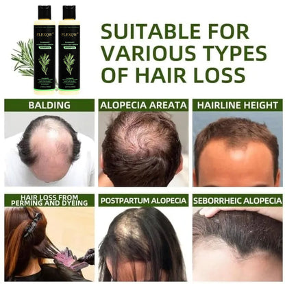 🌸Organic Rosemary Keratin Hair Growth Shampoo
