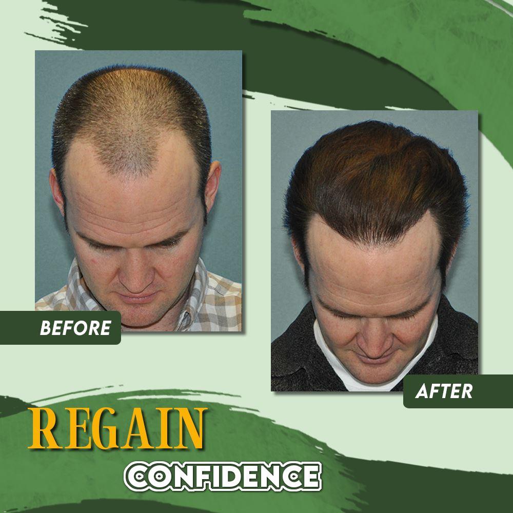 IMPROVE YOUR HAIR IN 7 DAYS
