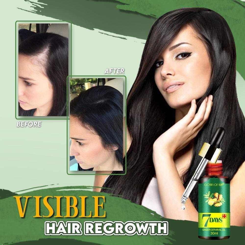 IMPROVE YOUR HAIR IN 7 DAYS